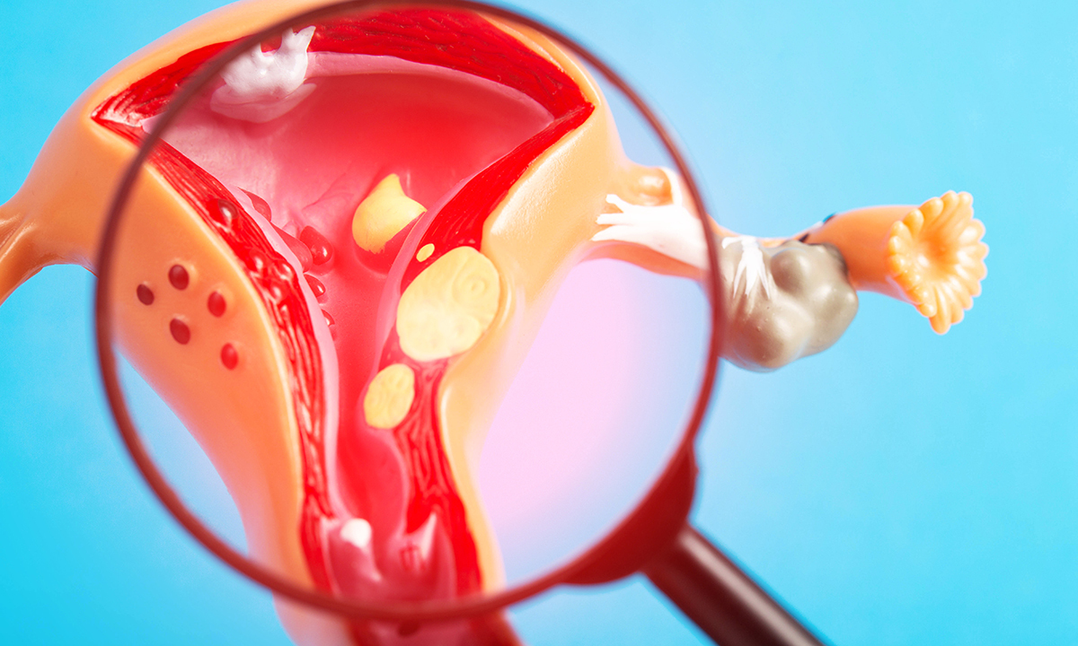 ‘혹’시 내가?… 가족 계획 땐 꼭 관리해야