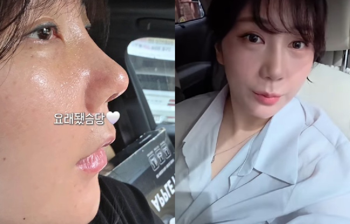 ‘구축 피해’ 고백한 개그우먼…재수술 후 리즈 갱신♥