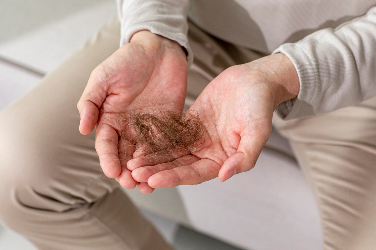 “탈모는 생존 문제” 李대통령 발언 이후…건보료만 내던 2030에 ‘바우처’ 지원될까